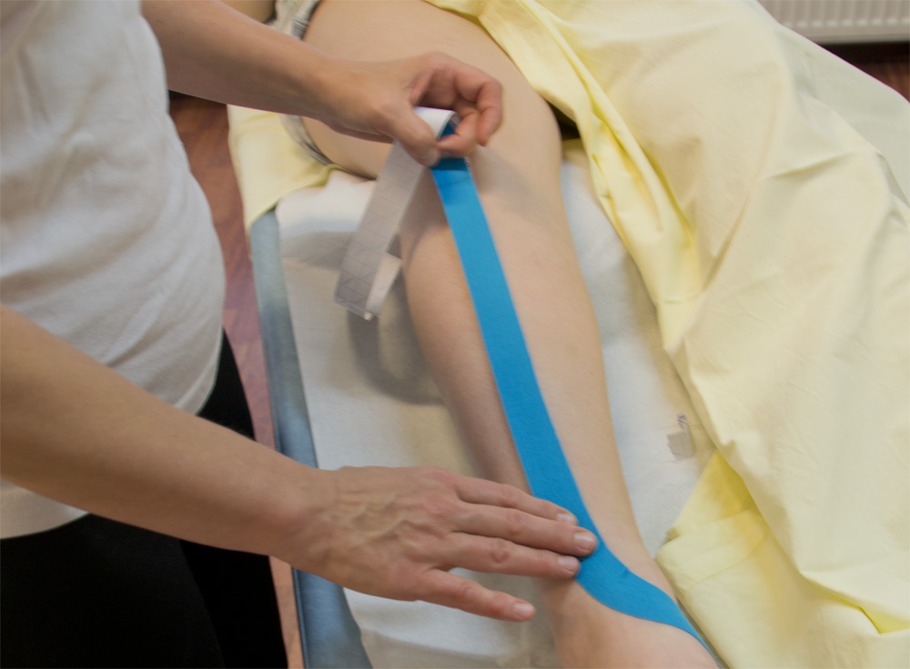 Etummaisen s&auml;&auml;rilihaksen teippaus.